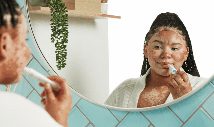 A woman stands in front of a mirror applying skincare product to her face. She has vitiligo, and her hair is styled in a high ponytail. The background features a shelf with a potted plant and blue tile. A reflection of her can also be seen in the mirror.