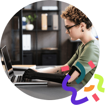 Young woman with prosthetic arm typing on laptop while sitting at office desk.